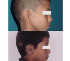 Reconstrucci&oacute;n Auricular